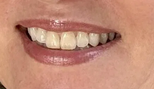 Verónica R.