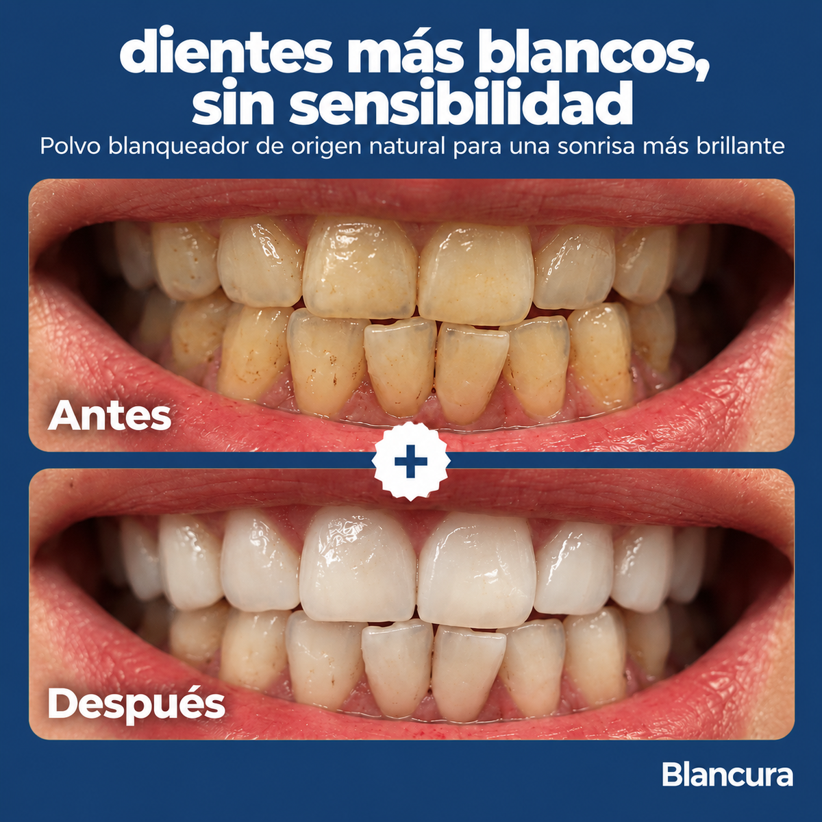 Polvo blanqueador dental de triple acción Blancura®